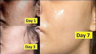 Close large pores with baby oil, aloe Vera gel, lemon, & sugar