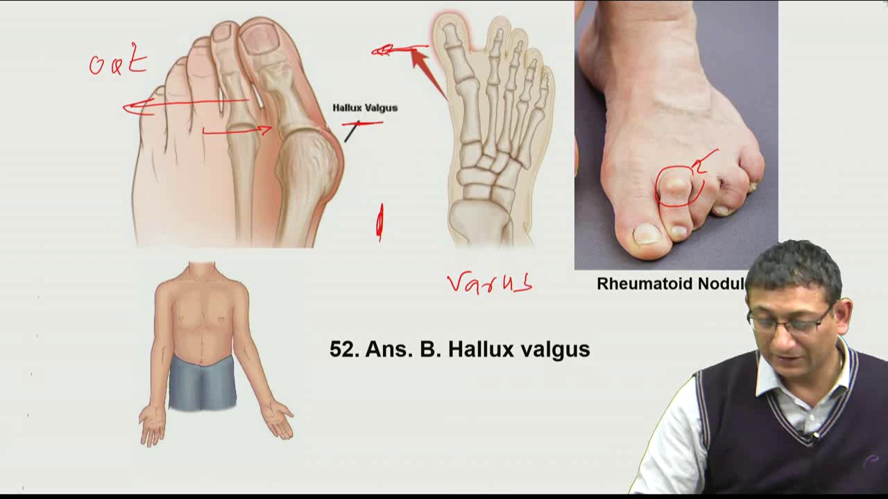GRAND TEST - 180 (ORTHOPEDICS)