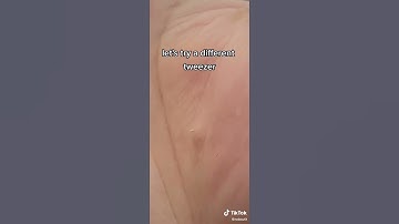 Thumbnail of Barber Hair Splinters