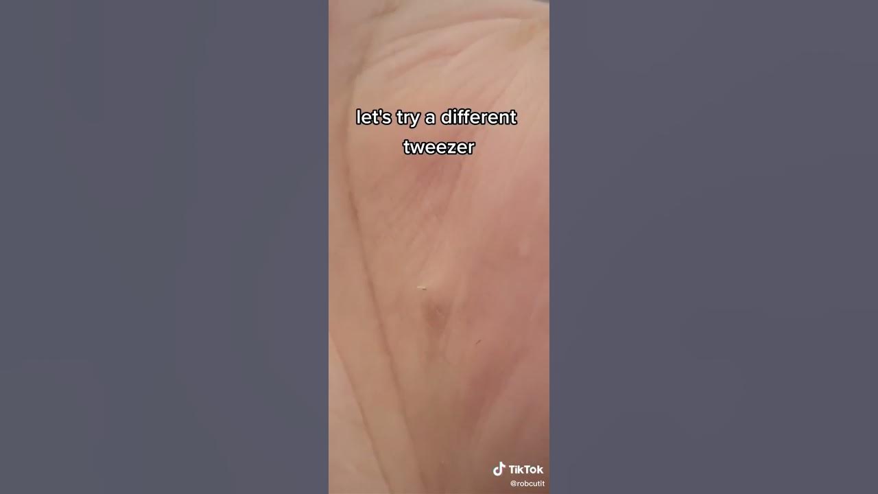 Barber Hair Splinters