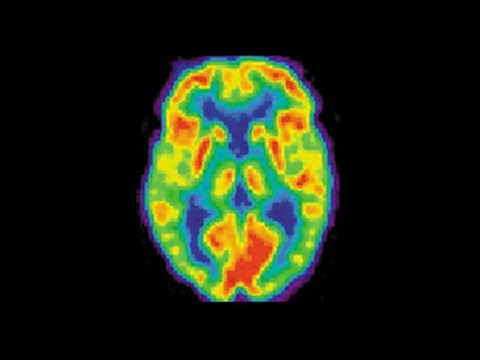 Det biologiska perspektivet -  neuropsykologi