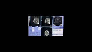 MRI Brain Planning and Protocols