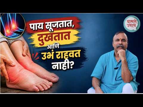 पाय वारंवार सूजतात, दुखतात - उभं राहायला त्रास होतो? कारण आणि उपाय | Foot Pain & Swelling Solution
