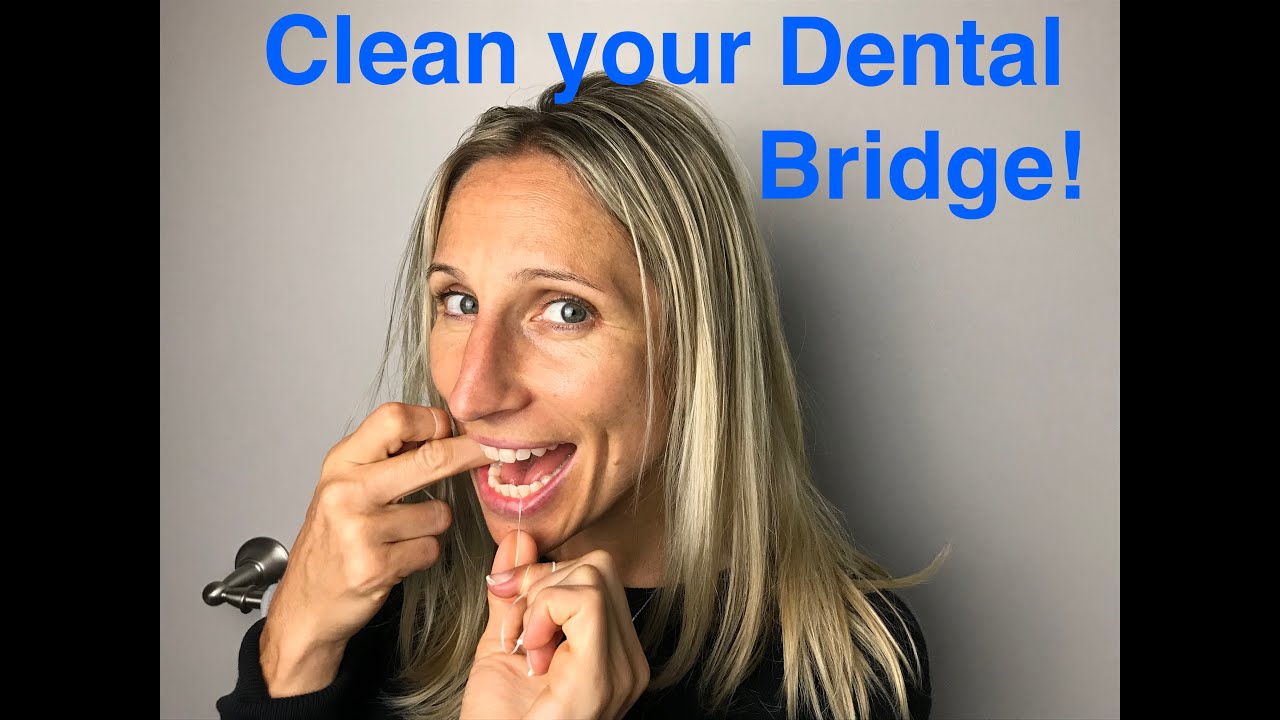 How to Remove Stains from Dental Bridges?