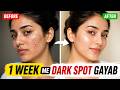 How to Remove Dark Spots & Acne Scars Fast | 7 Day Glow Routine (Hindi)