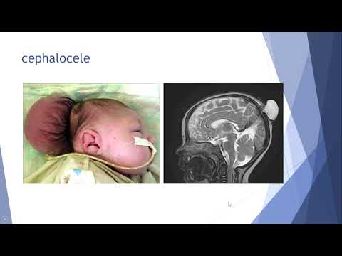 Malformations p 1   Lecture №16