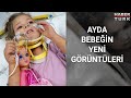 Mucize bebek Ayda'nın yeni görüntüleri!