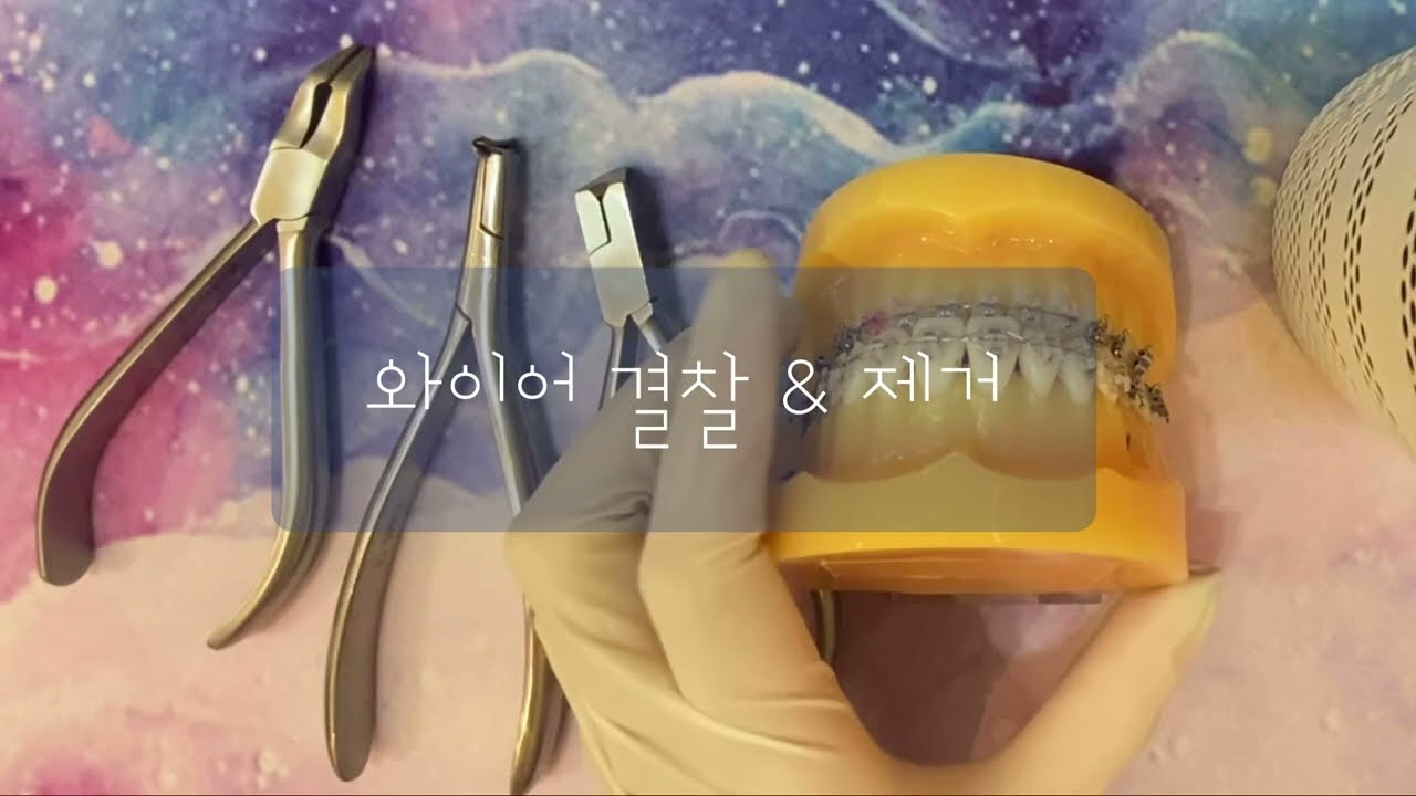 치아교정 와이어 결찰 & 제거하는 법