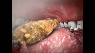 Chewing and Swallowing -  Animations
