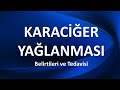 KARACİĞER YAĞLANMASI Belirtileri ve Tedavisi