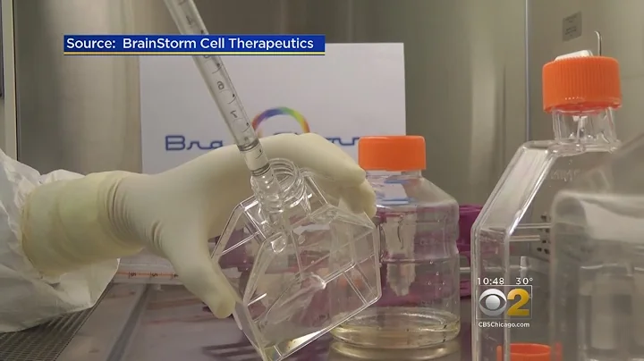 New Stem Cell Treatment Adds Tool In Fight Against ALS