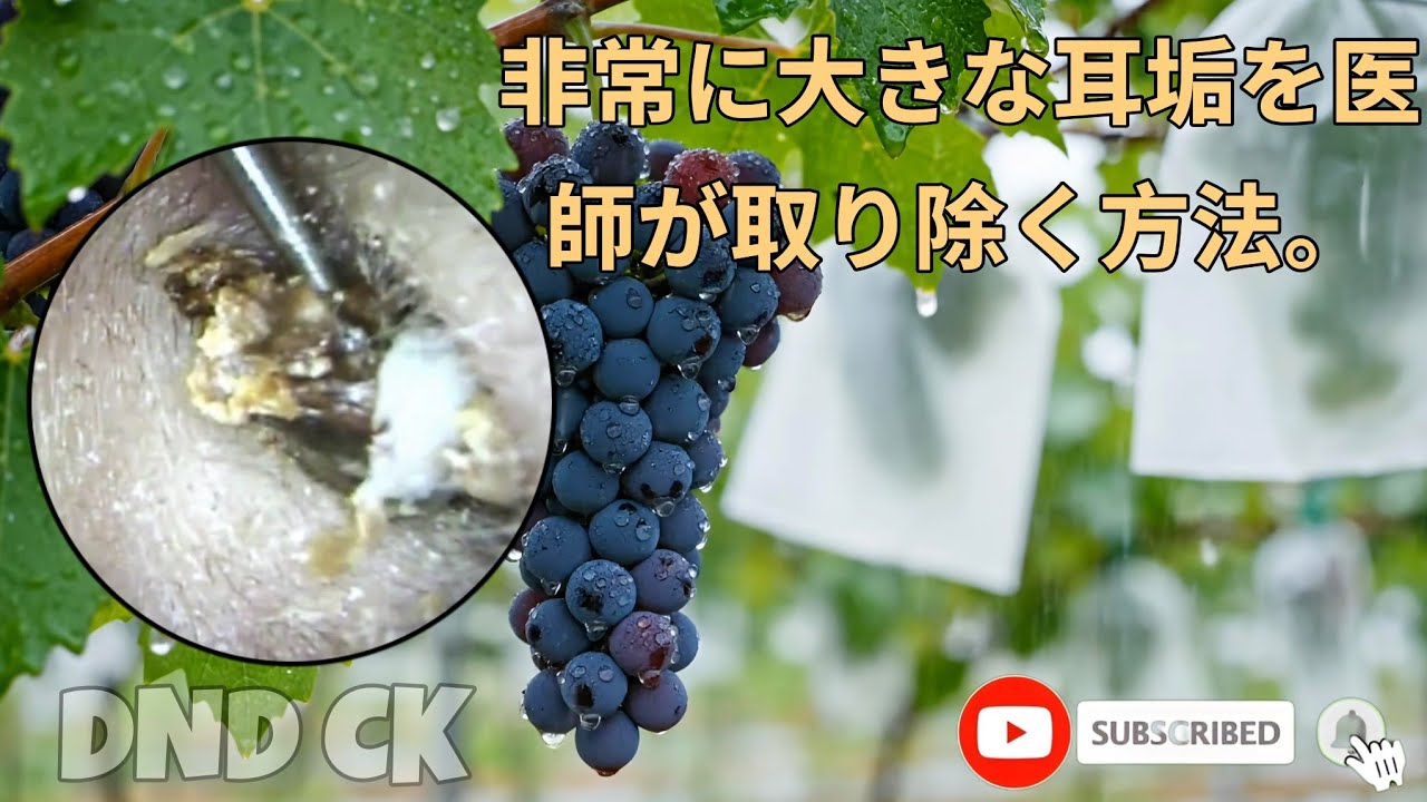 耳垢を丁寧に取り除く方法です。🌿👂EP01