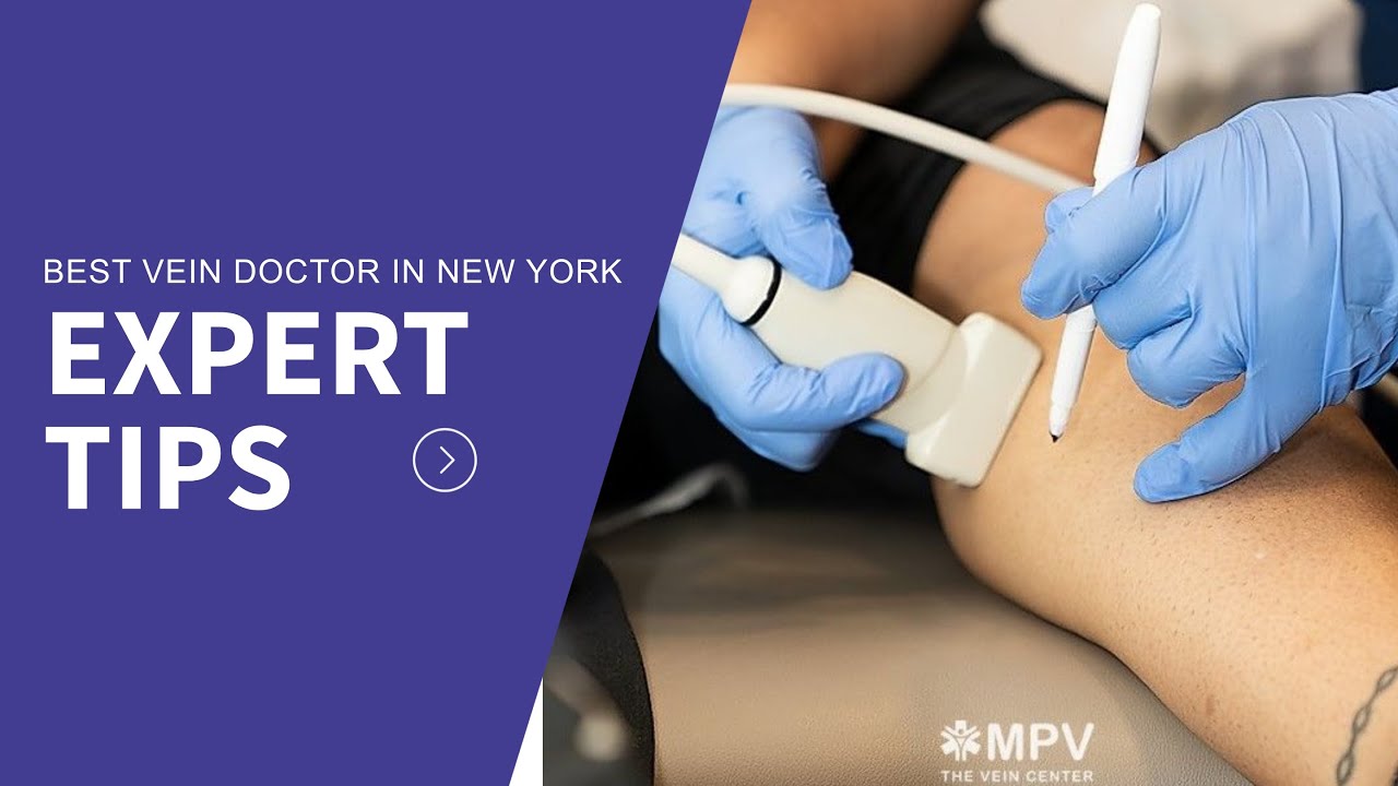 Best Vein Doctor in New York Vein Center Doctor - YouTube