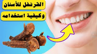 فوائد القرنفل للأسنان ، وكيفية استخدامه !