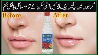 How To Get Rid Of Oily Skin At Home | Oily Skin Ka Ilaj | Skin Care Tips For Girls