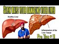 Pro Tips #11: Top 7 ways to keep your Liver healthy!
With out DETOX Dr.Education (Hindi)