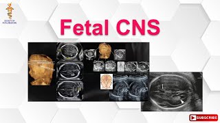 Fetal CNS screenshot 5