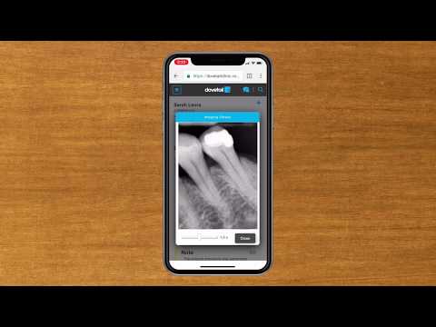 Mobile Functionality - Dovetail The 100% Mobile Dental Practice Management Software