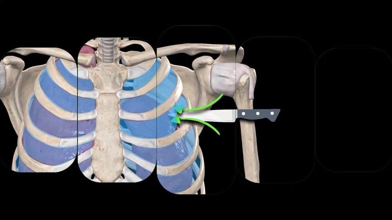 🆕 New Class Now Streaming in FOAMfrat Studio: Chest Trauma Essentials