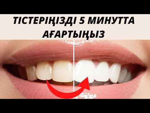 Бейне: Тісті ағарту сезімталдығымен қалай күресуге болады: 13 қадам