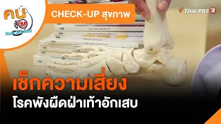 สุขภาพ เช็กความเสี่ยงเป็นโรคพังผืดฝ่าเท้าอักเสบ : CHECK UP