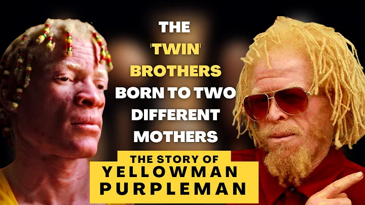 La historia de Yellowman y Purpleman: Los 'hermanos gemelos' nacidos de dos madres diferentes