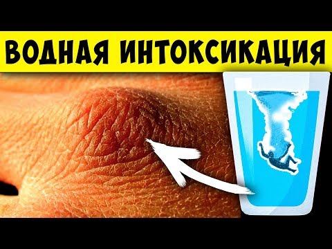 Все признаки, что вы Пьете слишком Много Воды! Водная интоксикация