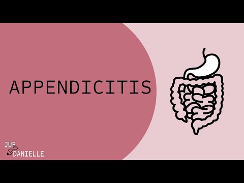 Video: Symptomen Van Appendicitis Bij Volwassenen En Kinderen, Bij Vrouwen En Mannen