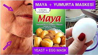 20 DAKİKADA MAYA VE YUMURTA İLE 5 YAŞ GENÇLEŞTİREN KIRIŞIKLIK GİDERİCİ MASKE #BOTOKS #CİLT BAKIMI