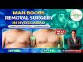 Man Boobs Removal Surgery in Hyderabad | Patient Success Story | Gynecomastia Surgery in Hyderabad