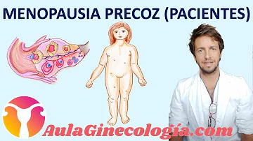 ¿Puede el síndrome de ovario poliquístico provocar una menopausia precoz?