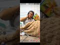 Ləman iynə vurdurmaqdan qorxur 😀(Pullingi səhv istifadə edib ona görə üzü yanıb)Abunə olun❤️#funny 