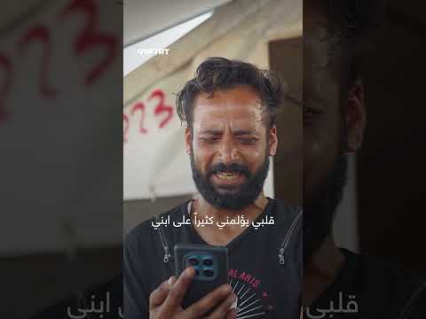 معاناة أم يمنية بسبب نقص التغذية لطفلها