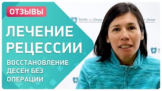 Лечение рецессии без операции 👉 уникальные комплексы Smile Recovery