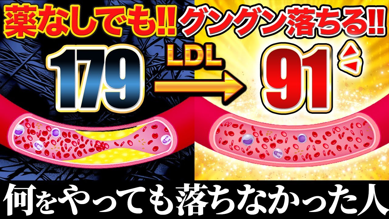 薬なしでも!現場で見たLDLコレステロールが下がった共通点【現役糖尿病内科医】