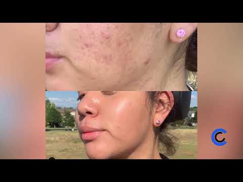 Body Love by Tal - Skin Care - August 20, 2020