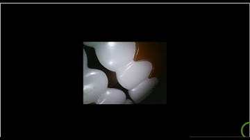 Training: Apteryx XVWeb - Acquiring Images Using an Intraoral Camera in XVCapture