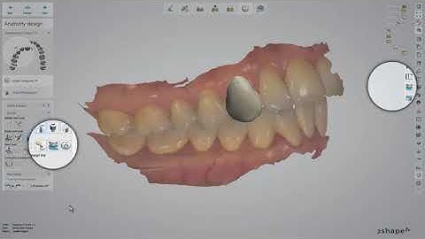 3Shape 덴탈 시스템 – 덴탈 시스템에서 Patient Specific Motion 사용하기