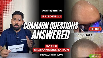 Scalp micropigmentation Questions and Answers - Real Answers #scalpmicropigmentation #smp