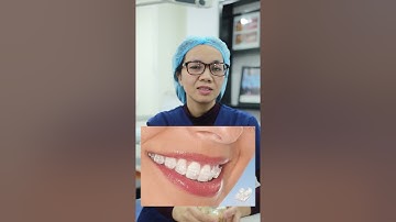 Hỏi đáp niềng răng P2 | Nha khoa Hân Đào #Shorts