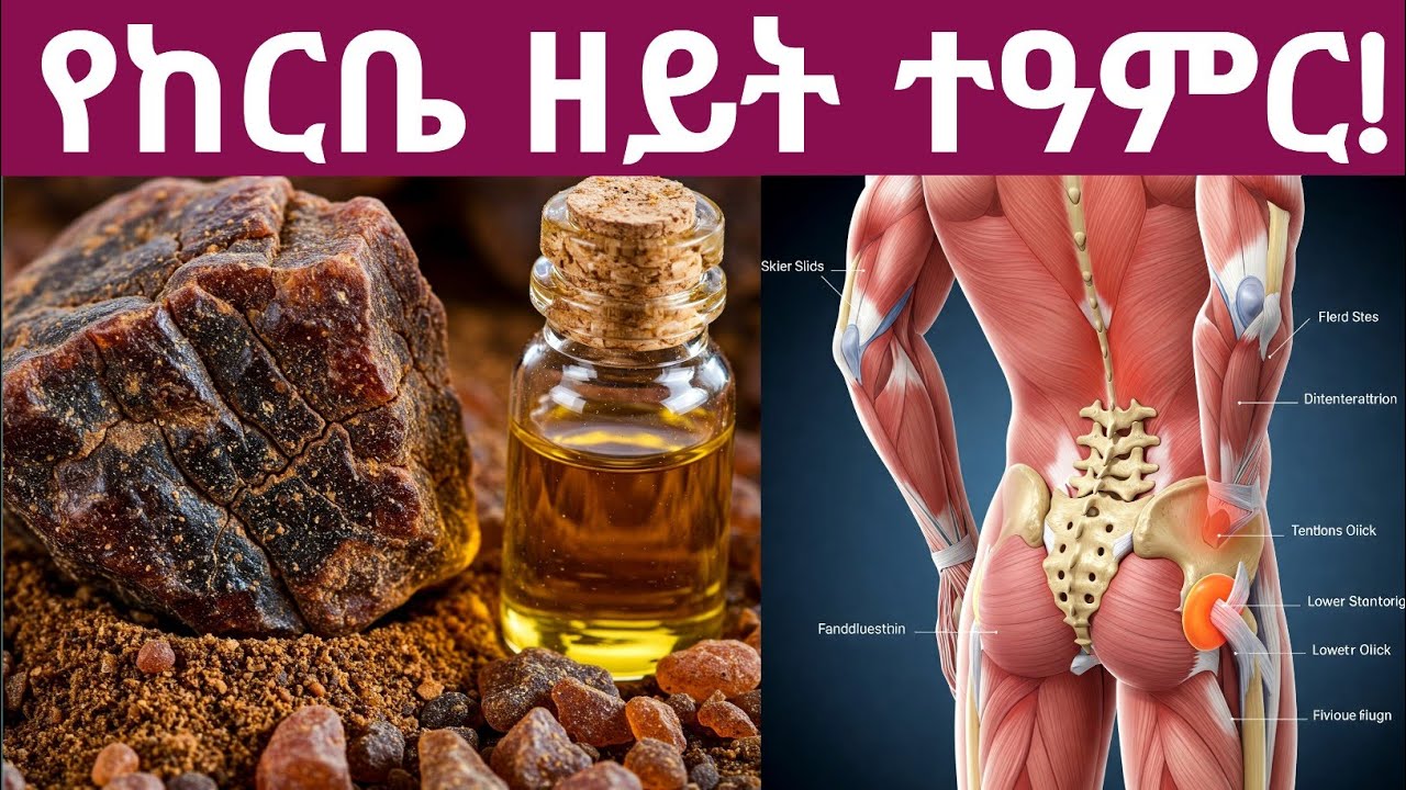 የከርቤ ዘይት አስደናቂና የማይታመን የጤና ጥቅሞችና አጠቃቀም| 11 Surprising Benefits and Uses of Myrrh Oil