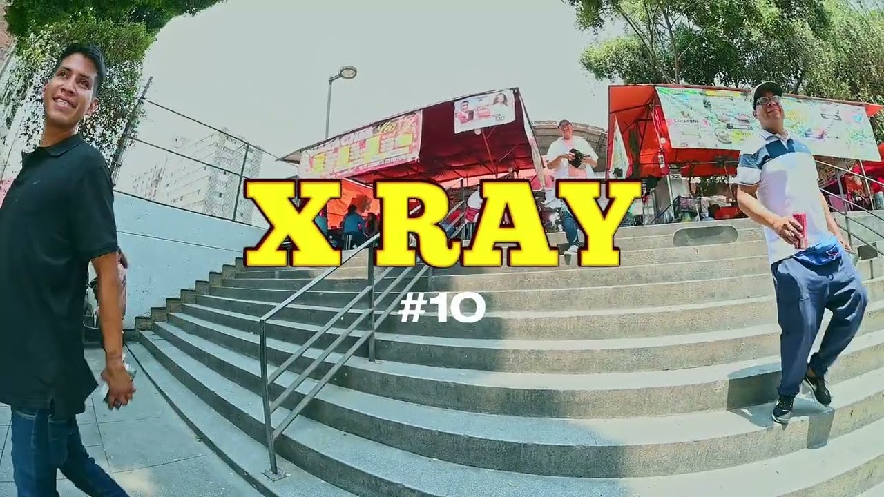 XRAY #10- GALLITO ANGEL DAVILA