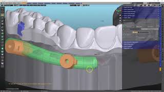 B4D Stackable Guide 15