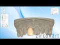 Proceso de diseo de una prtesis fija con software cadcam  zirconart