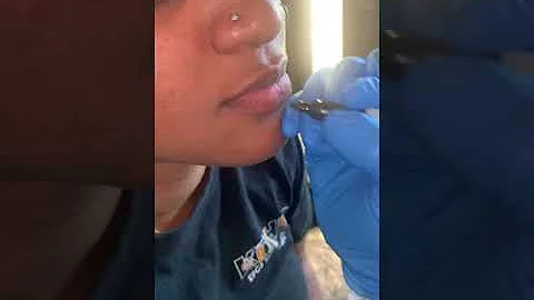 Come si toglie il labret?