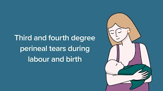 Third and fourth degree perineal tears: A video for women