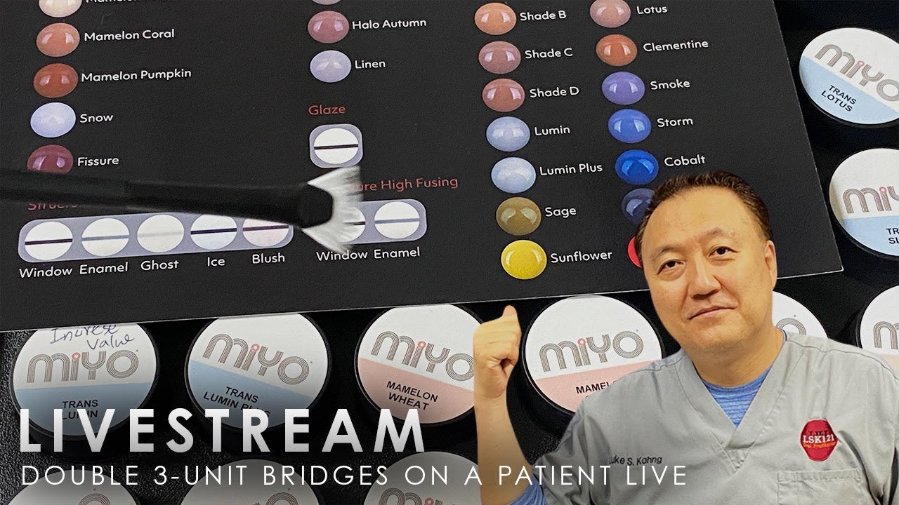 Double 3-Unit Bridge on a Patient Live - YouTube