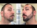 How to grow a REAL Beard | Minoxidil 4 Month Beard Journey