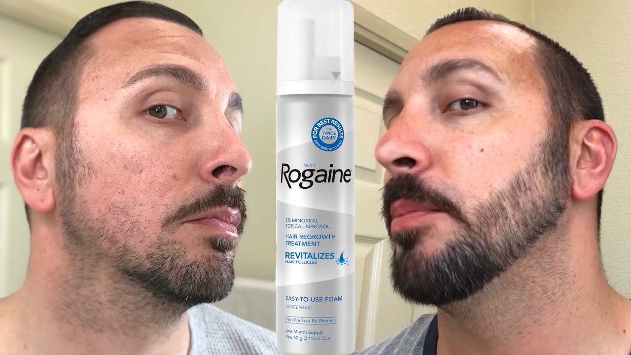 pics Rogaine For Beard Side Effects youtube. pic Rogaine For Beard Side E.....