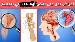 أعراض تدل على نقص أوميغا 3 في الجسم - لا تتجاهل هذه العلامات التحذيرية | نقص اوميغا 3 خطير جداً عليك